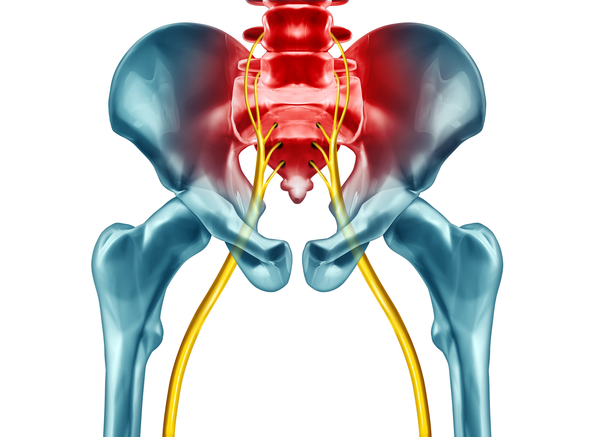 Read more about the article Sciatic Nerve Pain Relief